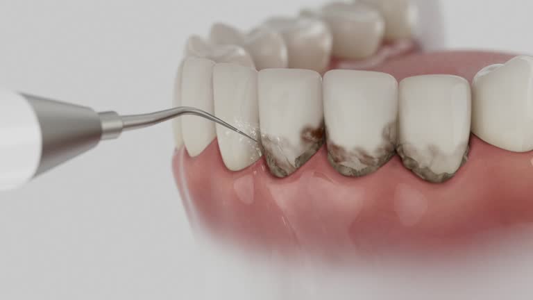 Reliable Dental Implants contractor in Dandridge, TN by Smile Center Dentistry